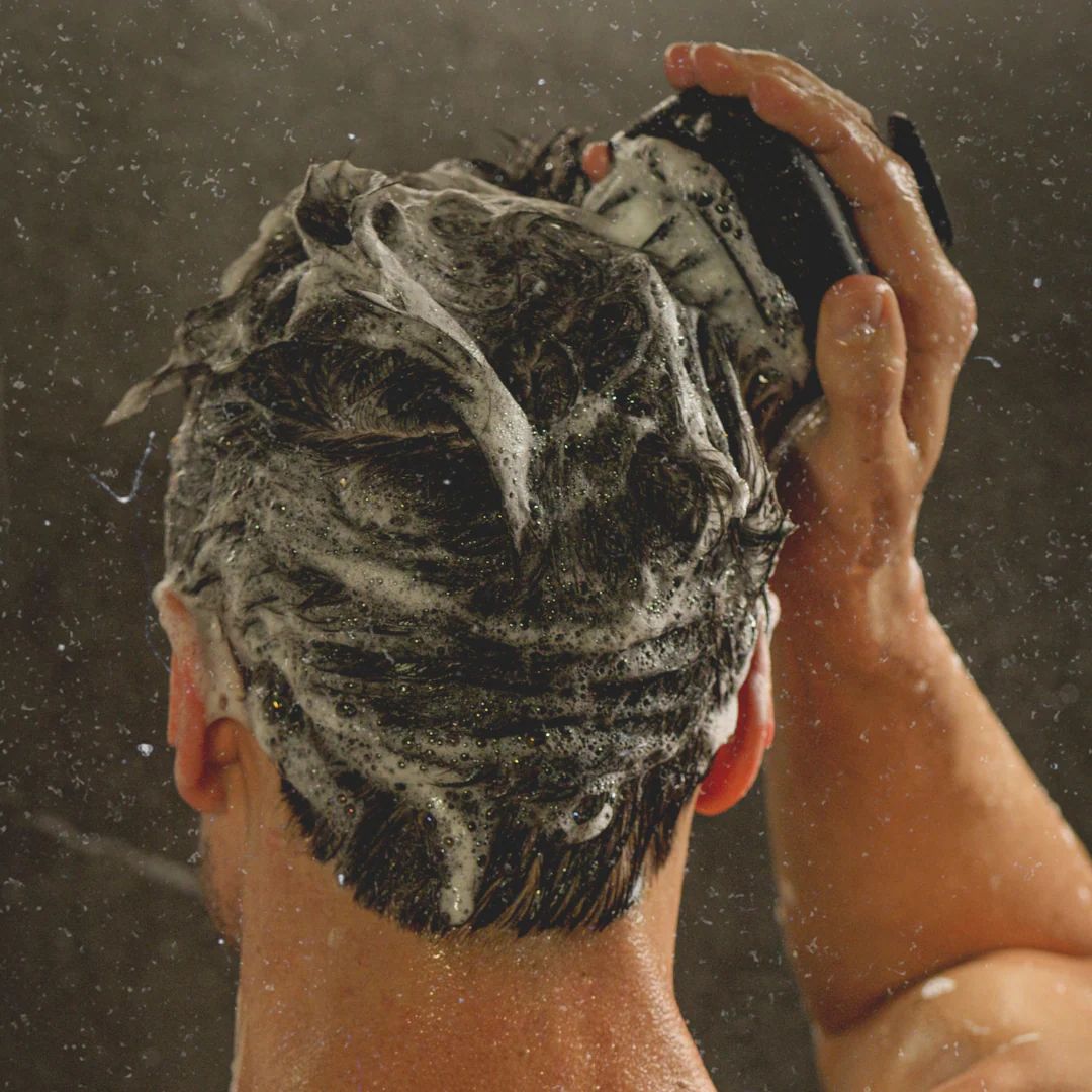 Dandruff Control Kit - Image 4