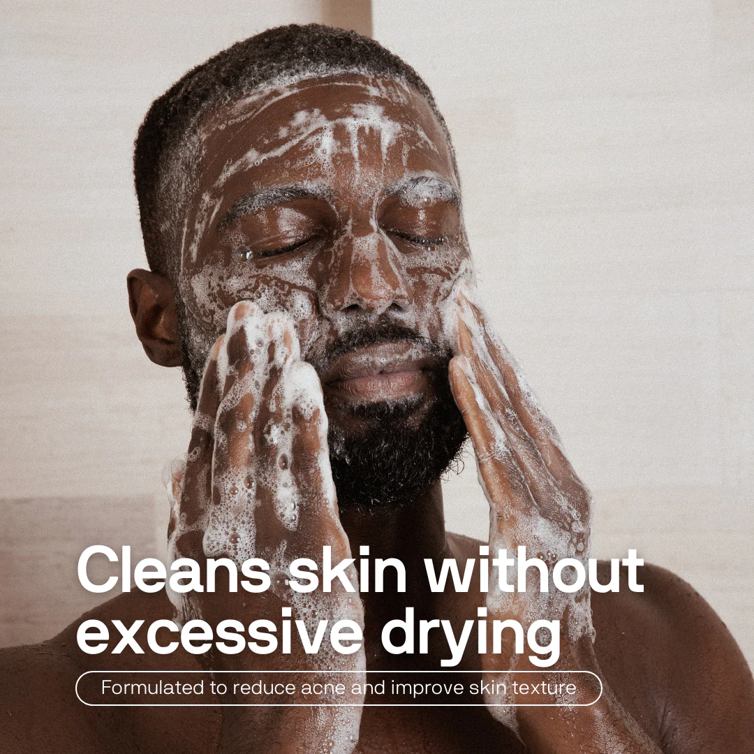 Body Acne System - Image 4